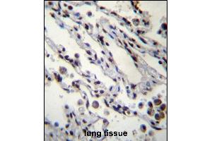 HIST1H2BN Antibdy (N-term) (ABIN657039 and ABIN2846210) immunohistochemistry analysis in formalin fixed and paraffin embedded human lung tissue followed by peroxidase conjugation of the secondary antibody and DAB staining. (HIST1H2BN anticorps  (N-Term))