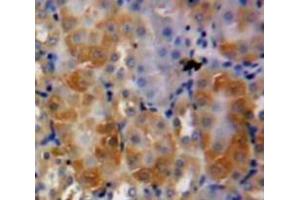 IHC-P analysis of Kidney tissue, with DAB staining. (Midkine anticorps  (AA 22-143))