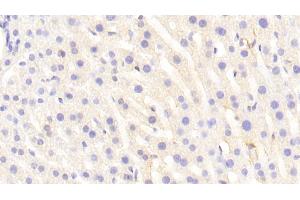 Detection of VCAM1 in Mouse Liver Tissue using Polyclonal Antibody to Vascular Cell Adhesion Molecule 1 (VCAM1)