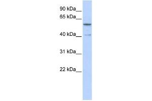 WB Suggested Anti-ZNF284 Antibody Titration:  0. (ZNF284 anticorps  (C-Term))