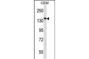 Western blot analysis in CEM cell line lysates (35ug/lane). (AATK anticorps  (N-Term))