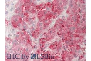 IHC-P analysis of Human Adrenal Gland Tissue, with HE staining. (Neuropilin 1 anticorps  (AA 646-814))