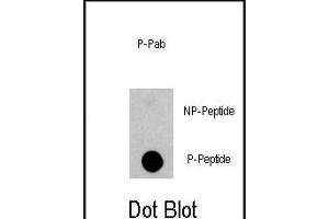 Dot blot analysis of anti-EGFR-p Phospho-specific Pab (ABIN1944845 and ABIN2839700) on nitrocellulose membrane. (EGFR anticorps  (pSer1070))