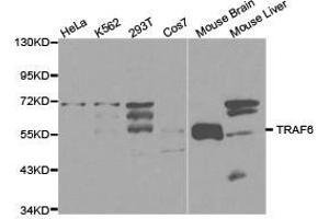Western Blotting (WB) image for anti-TNF Receptor-Associated Factor 6 (TRAF6) antibody (ABIN1875195) (TRAF6 anticorps)