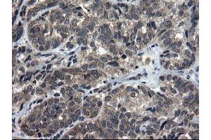 Immunohistochemistry (IHC) image for anti-Docking Protein 7 (DOK7) antibody (ABIN1497883)