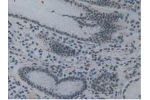 IHC-P analysis of Human Stomach Tissue, with DAB staining. (TOR1A anticorps  (AA 33-321))