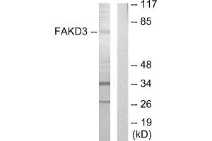 Western blot analysis of extracts from HepG2 cells, using FAKD3 antibody.