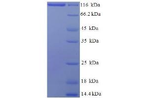 SDS-PAGE (SDS) image for Major Vault Protein (MVP) (AA 2-893) protein (His-SUMO Tag) (ABIN5709981)