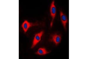 Immunofluorescent analysis of ARHGAP17 staining in Lovo cells. (ARHGAP17 anticorps  (Center))