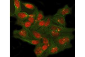 IF analysis of TSHZ1 using anti-TSHZ1 antibody (ABIN7602710) and anti-Tubulin Alpha antibody (ABIN7600339).