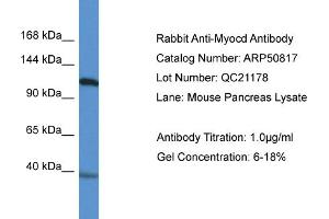 WB Suggested Anti-Myocd Antibody   Titration: 1.