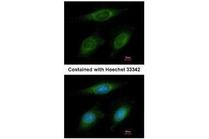 ICC/IF Image Immunofluorescence analysis of methanol-fixed HeLa, using RNF6, antibody at 1:200 dilution.