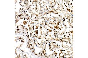 Immunohistochemistry of paraffin-embedded human lung using BHLHE40 Rabbit pAb (ABIN6129354, ABIN6137550, ABIN6137551 and ABIN6222195) at dilution of 1:150 (40x lens).