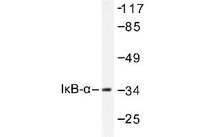 Image no. 1 for anti-Nuclear Factor of kappa Light Polypeptide Gene Enhancer in B-Cells Inhibitor, alpha (NFKBIA) antibody (ABIN265483) (NFKBIA anticorps)