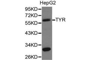 Western Blotting (WB) image for anti-Tyrosinase (TYR) antibody (ABIN1875241) (TYR anticorps)