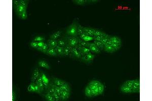 Immunocytochemistry/Immunofluorescence analysis using Rabbit Anti-TNF-R1 Polyclonal Antibody .