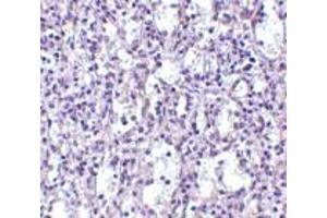Immunohistochemistry of Carabin in human spleen tissue with Carabin antibody at 2.