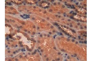Detection of PKCe in Human Kidney Tissue using Polyclonal Antibody to Protein Kinase C Epsilon (PKCe)