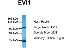 Host: Rabbit Target Name: EVI1 Sample Tissue: Human 293T Antibody Dilution: 1. (MECOM anticorps  (C-Term))