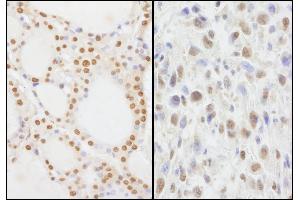 anti-Zinc Finger Protein 335 (ZNF335) (AA 300-350) antibody