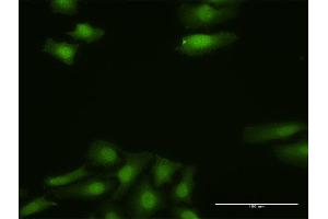Immunofluorescence of purified MaxPab antibody to FGF13 on HeLa cell. (FGF13 anticorps  (AA 1-245))