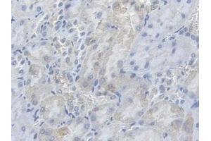 Detection of PFKM in Rat Kidney Tissue using Polyclonal Antibody to Phosphofructokinase, Muscle (PFKM)