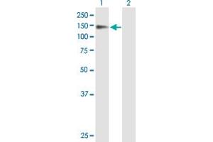 Western Blot analysis of PSD expression in transfected 293T cell line by PSD MaxPab polyclonal antibody. (PSD anticorps  (AA 1-1024))