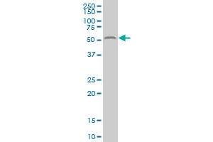ALG1 polyclonal antibody (A01), Lot # 051220JC01 Western Blot analysis of ALG1 expression in HeLa .