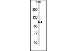 Western blot analysis of RanBP11 / Importin-11 Antibody (C-term) Cat. (Importin 11 anticorps  (C-Term))