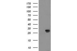 Western Blotting (WB) image for anti-Nicotinamide N-Methyltransferase (NNMT) antibody (ABIN1499790)