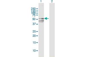 Western Blot analysis of RBMY1F expression in transfected 293T cell line by RBMY1F MaxPab polyclonal antibody.