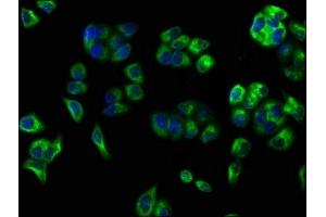 Immunofluorescence staining of PC-3 cells with ABIN7147166 at 1:100, counter-stained with DAPI.