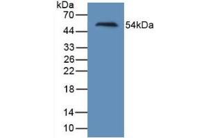 Detection of Recombinant Kim1, Human using Monoclonal Antibody to Kidney Injury Molecule 1 (Kim1) (HAVCR1 anticorps  (AA 21-240))