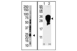 Image no. 1 for anti-Ubiquitin-Conjugating Enzyme E2S (UBE2S) (C-Term) antibody (ABIN357498) (UBE2S anticorps  (C-Term))