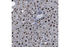 Immunohistochemical staining (Formalin-fixed paraffin-embedded sections) of human liver with PTPN1 polyclonal antibody  shows strong nuclear positivity in hepatocytes. (PTPN1 anticorps  (AA 268-406))