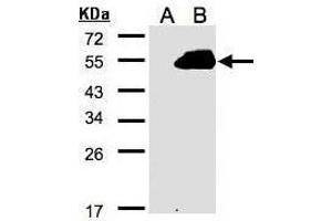 WB Image Western Blot analysis of RASSF9 expression in transfected 293T cell line by RASSF9 polyclonal antibody. (RASSF9 anticorps  (C-Term))