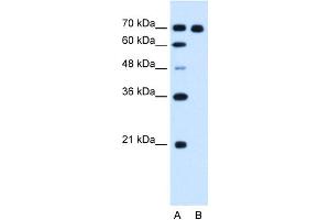 WB Suggested Anti-RRM1 Antibody Titration:  1. (RRM1 anticorps  (C-Term))