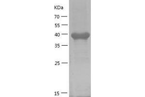 Western Blotting (WB) image for NF-kappa-B inhibitor beta (NFKBIB) (AA 1-356) protein (His tag) (ABIN7124163)
