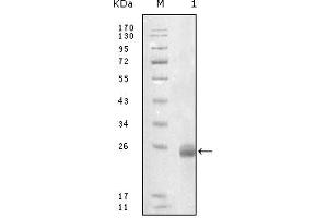 Western blot analysis using FBLN5 mouse mAb against truncated FBLN5-His recombinant protein. (Fibulin 5 anticorps)