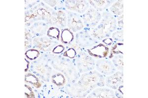 Immunohistochemistry of paraffin-embedded rat kidney using HSP70/HSP Rabbit pAb  at dilution of 1:100 (40x lens).