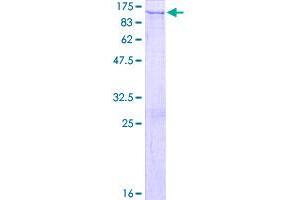 Image no. 1 for Proprotein Convertase Subtilisin/kexin Type 5 (PCSK5) (AA 1-913) protein (GST tag) (ABIN1314358)