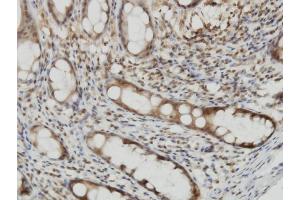 Immunoperoxidase of monoclonal antibody to CYTH2 on formalin-fixed paraffin-embedded human colon. (Cytohesin 2 anticorps  (AA 314-398))