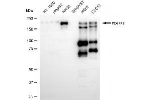 Western blotting analysis using PDGFRB antibody (ABIN7799848). (Recombinant PDGFRB anticorps)
