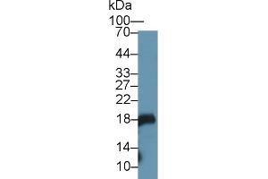 Detection of GKN1 in Mouse Stomach lysate using Polyclonal Antibody to Gastrokine 1 (GKN1) (Gastrokine 1 anticorps  (AA 27-151))