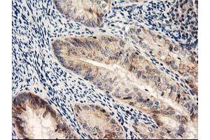 Image no. 3 for anti-N-Acyl Phosphatidylethanolamine phospholipase D (NAPEPLD) antibody (ABIN1499643)