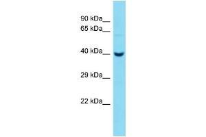 Host:  Rabbit  Target Name:  Pcmtd2  Sample Type:  Mouse Liver lysates  Antibody Dilution:  1. (PCMTD2 anticorps  (C-Term))