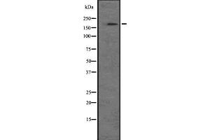 Western blot analysis of NRK expression in A549 cell line lysate ,The lane on the left is treated with the antigen-specific peptide. (NRK anticorps)