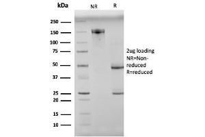 SDS-PAGE Analysis Purified N-Cadherin Mouse Monoclonal Antibody (8C11). (N-Cadherin anticorps  (Extracellular Domain))