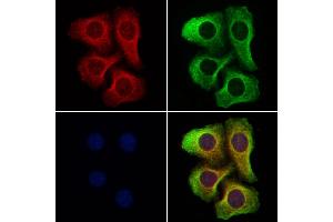 ABIN6262578 and ABIN6277333 staining Hela cells by IF/ICC. (IMMT anticorps  (Internal Region))
