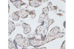 Immunohistochemistry of paraffin-embedded Human placenta using KRT7 Polyclonal Antibody at dilution of 1:100 (40x lens). (Cytokeratin 7 anticorps)